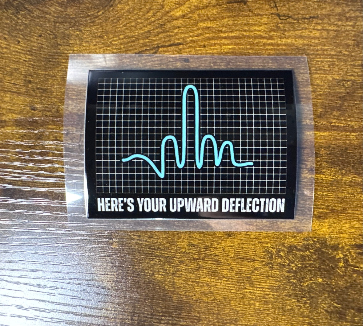 Upward Deflection