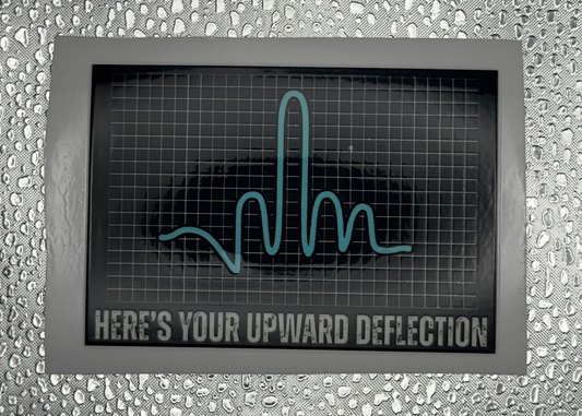 Upward Deflection